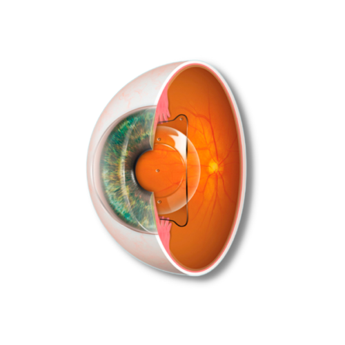 operación vista cansada lentes