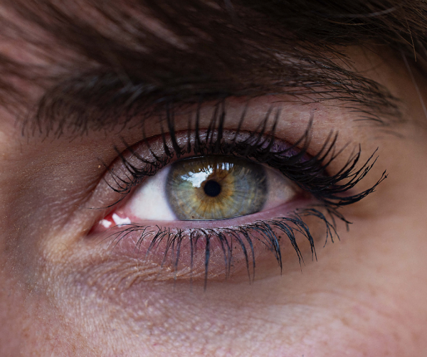 heterocromía central