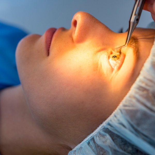 operación miopía precio