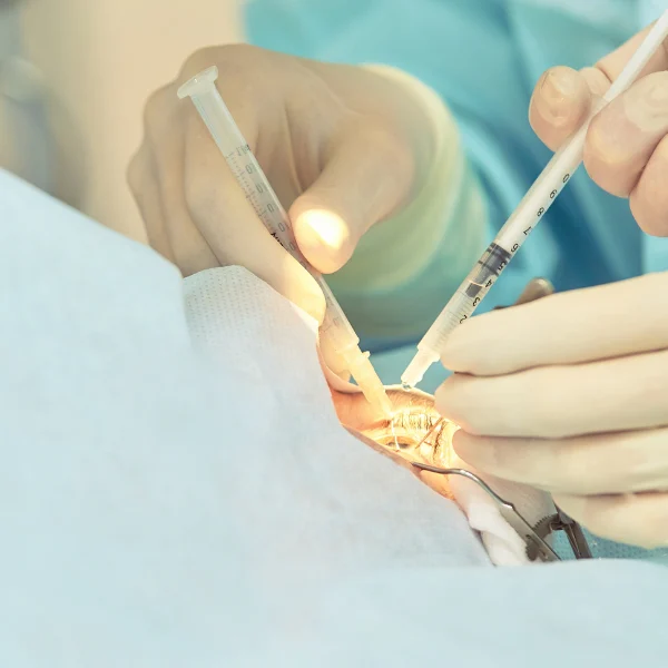 qué cuidados debe tener una persona con desprendimiento de retina