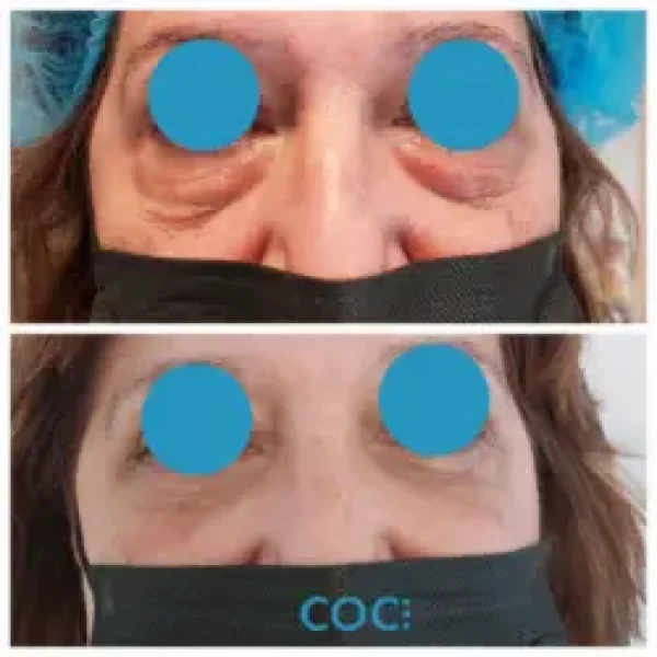 PASO-1-2023-10-26T122513.125-250x250