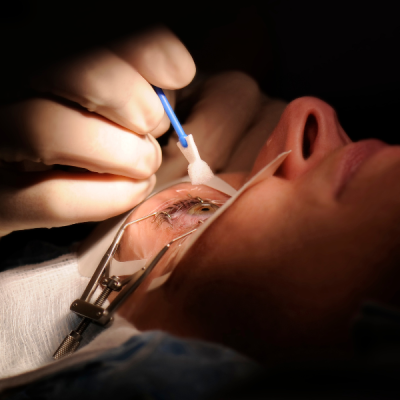 operacion hipermetropia y astigmatismo